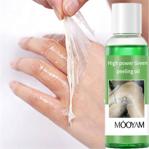 Peeling Oil for Dark Skin, Green Peeling Oil Extra Strength, Extra Strong Peeling Oil for Hand, Feet and All Body, Chemical Peel for Face at Home,110ML/3.88Oz (1 PCS)