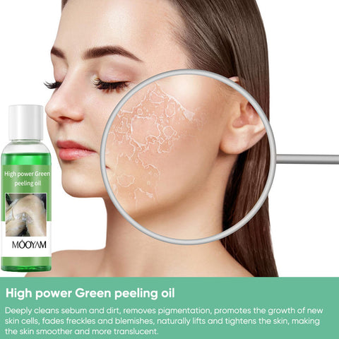 Peeling Oil for Dark Skin, Green Peeling Oil Extra Strength, Extra Strong Peeling Oil for Hand, Feet and All Body, Chemical Peel for Face at Home,110ML/3.88Oz (1 PCS)